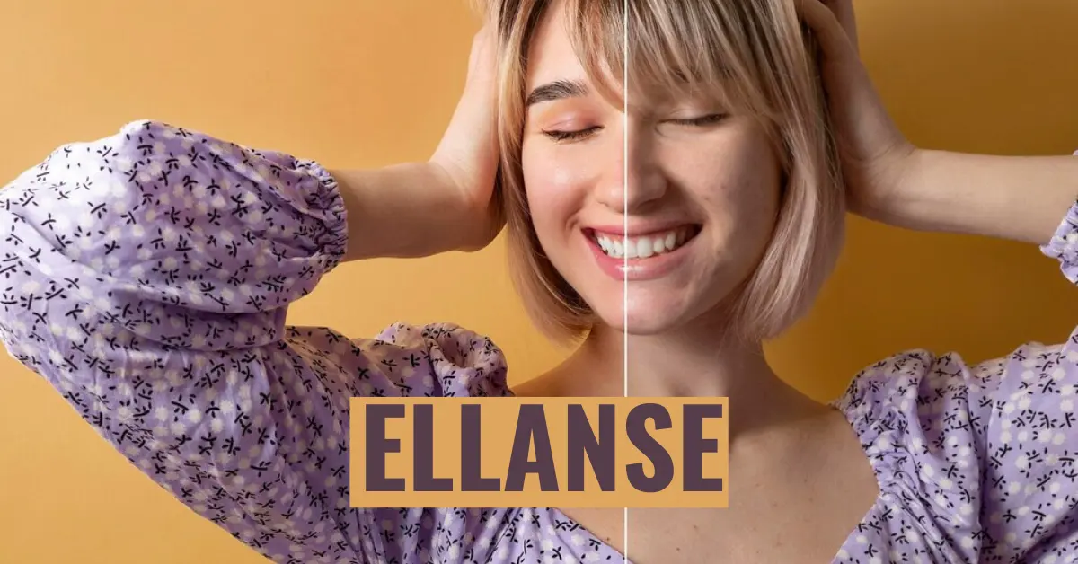Everything About Ellanse