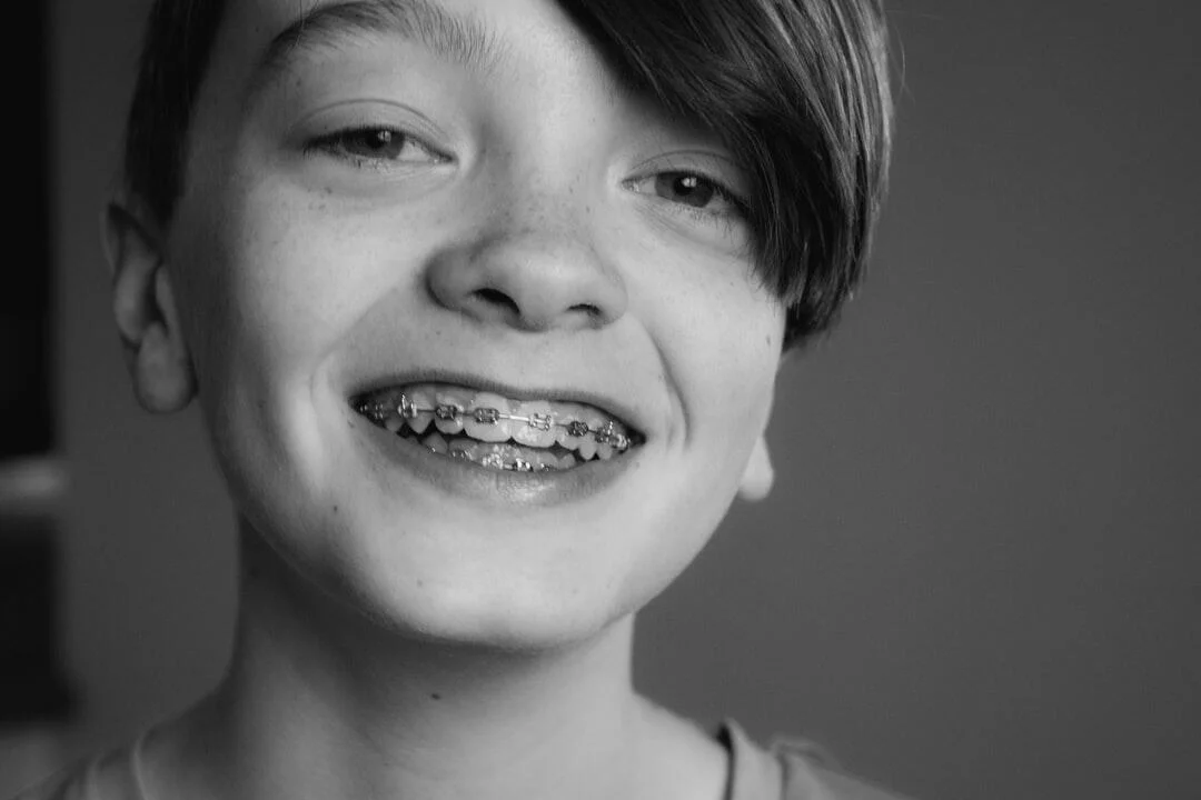 types of braces