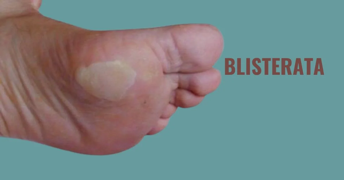 what is blisterata