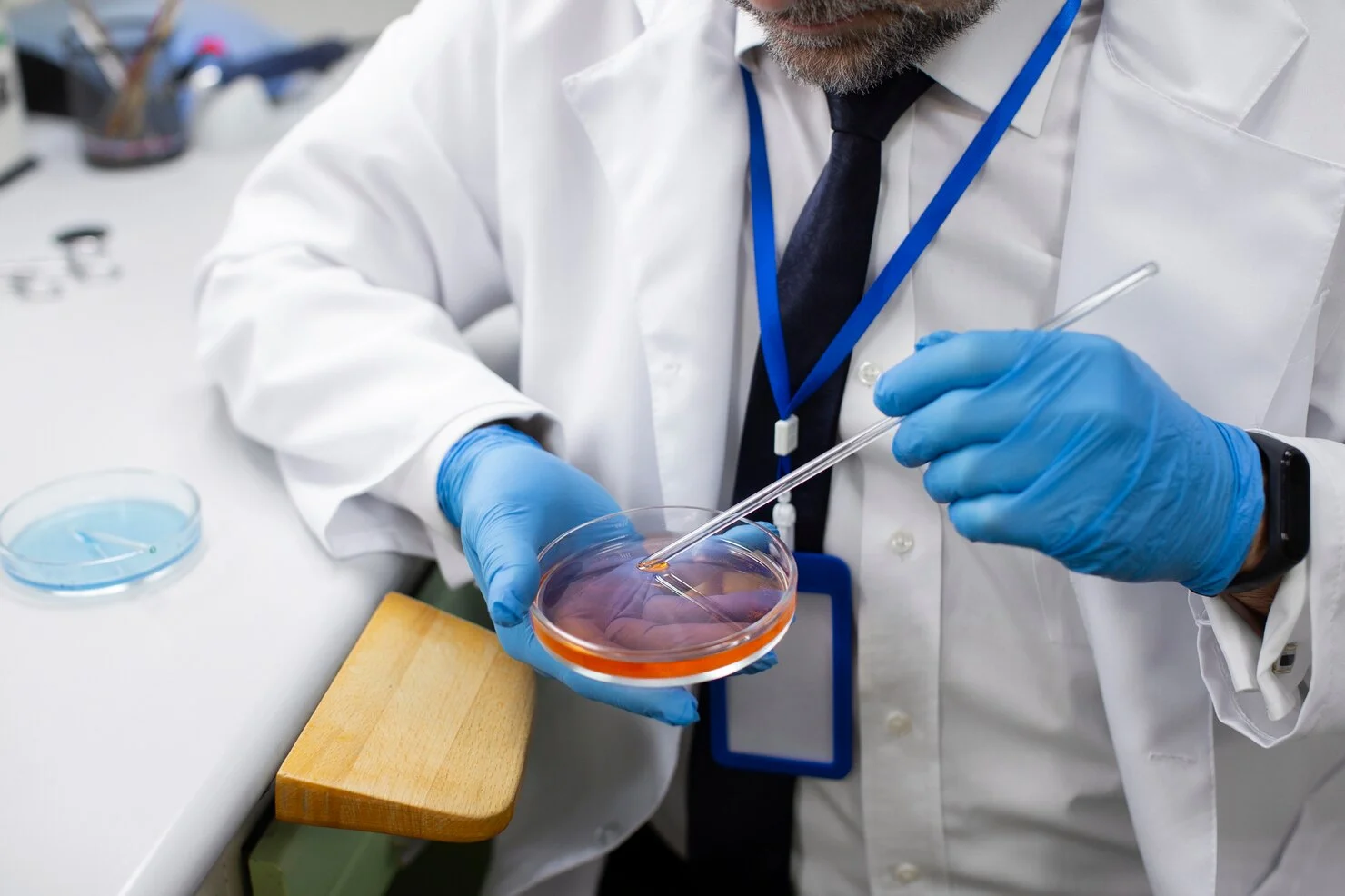 E. coli