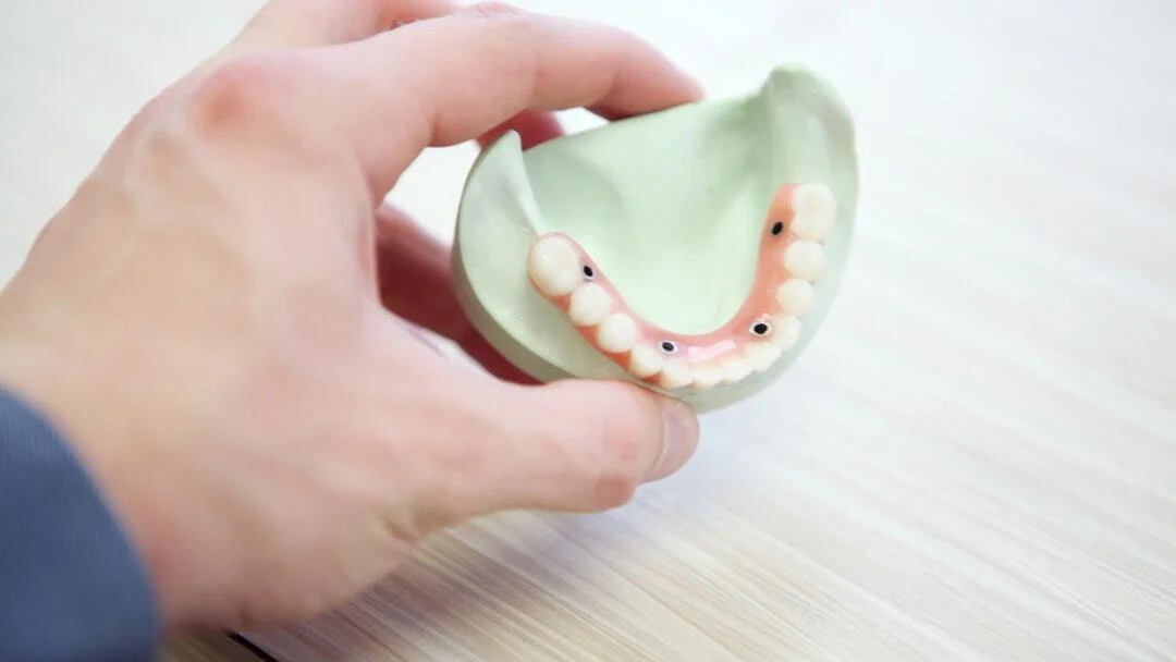 types of dental implants
