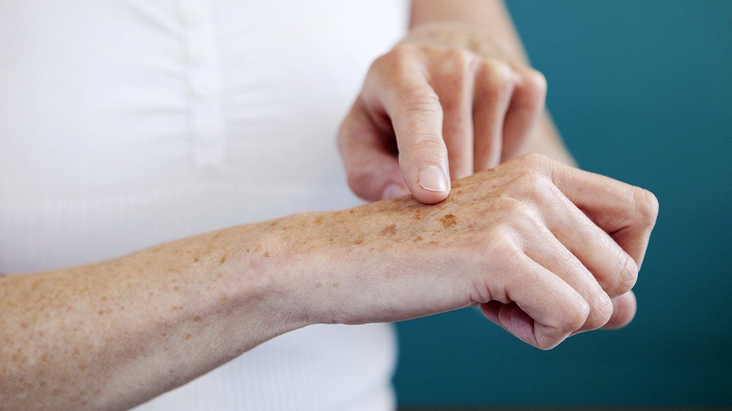 Skin Problems