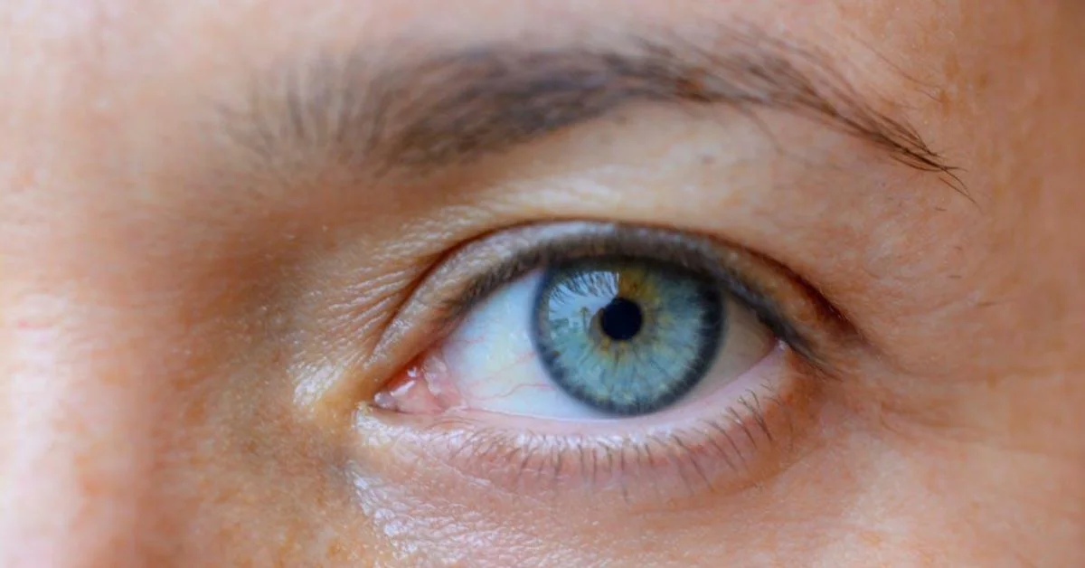 LASER EYE SURGERY