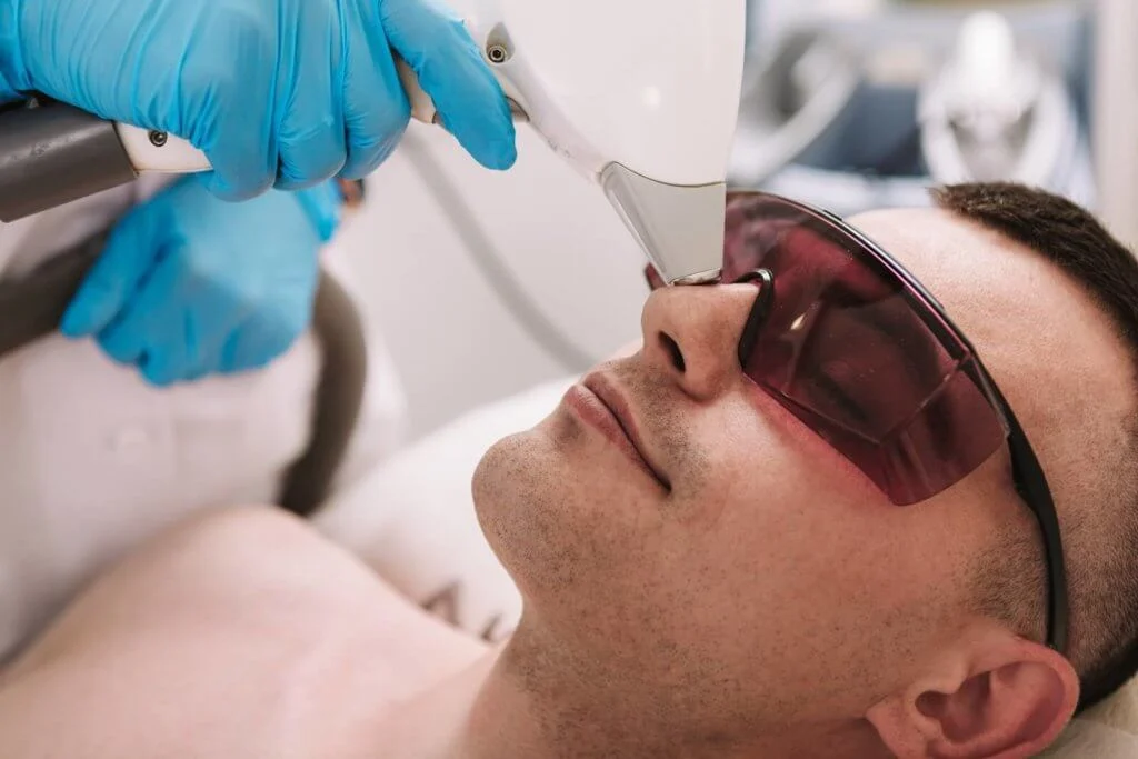 Laser Hair Removal