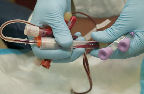 Kidney Transplant Overseas: Better Blood & Creatinine Level