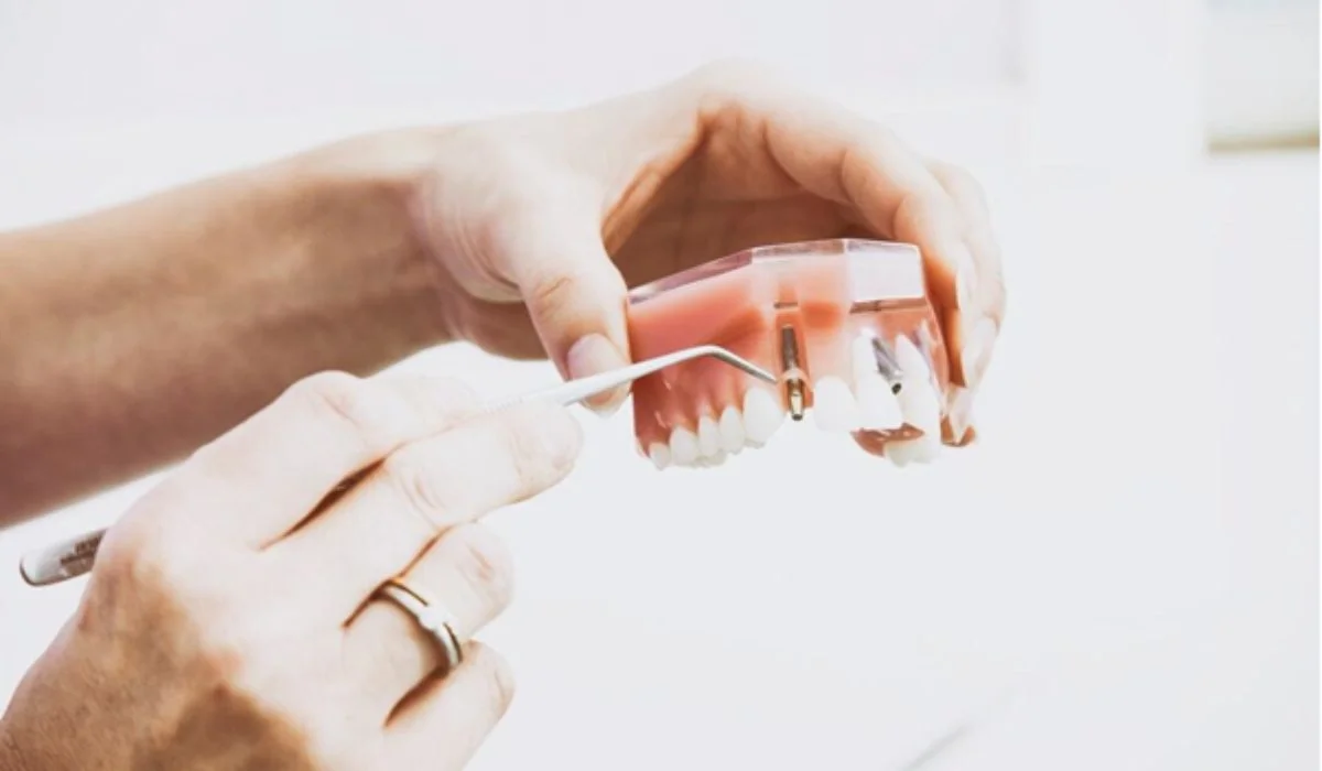 teeth reconstruction