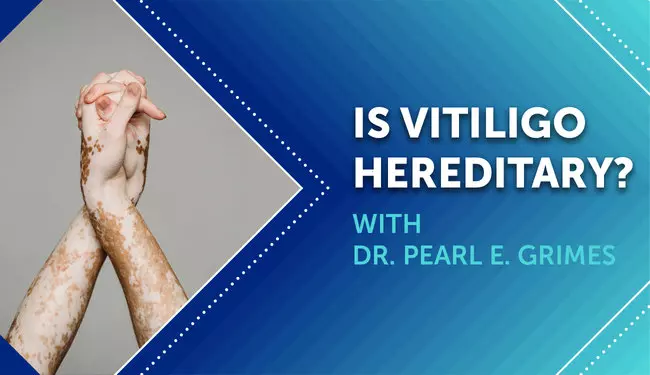 Is Vitiligo Genetic
