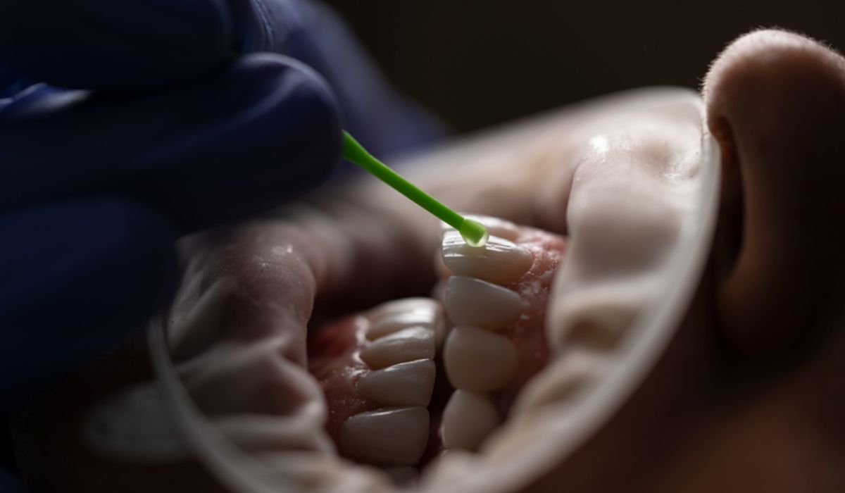 deep cleaning teeth