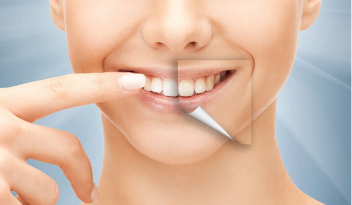 affordable cosmetic dentistry