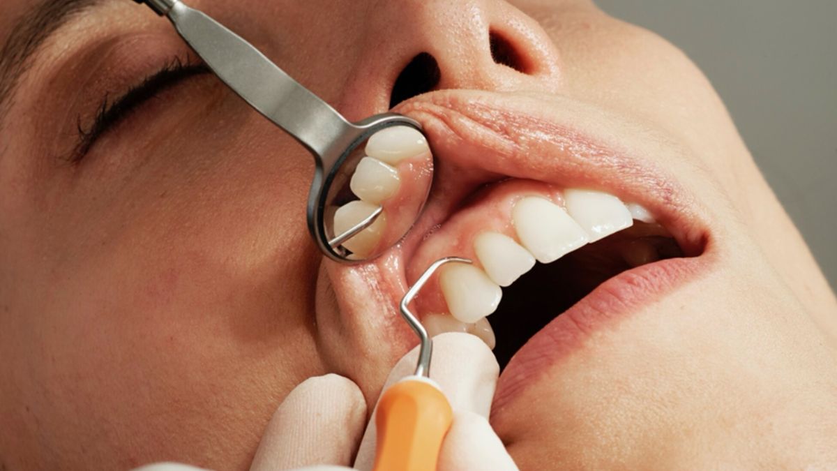 periodontal cleaning
