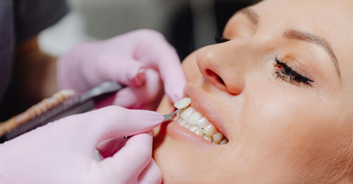 veneer procedure