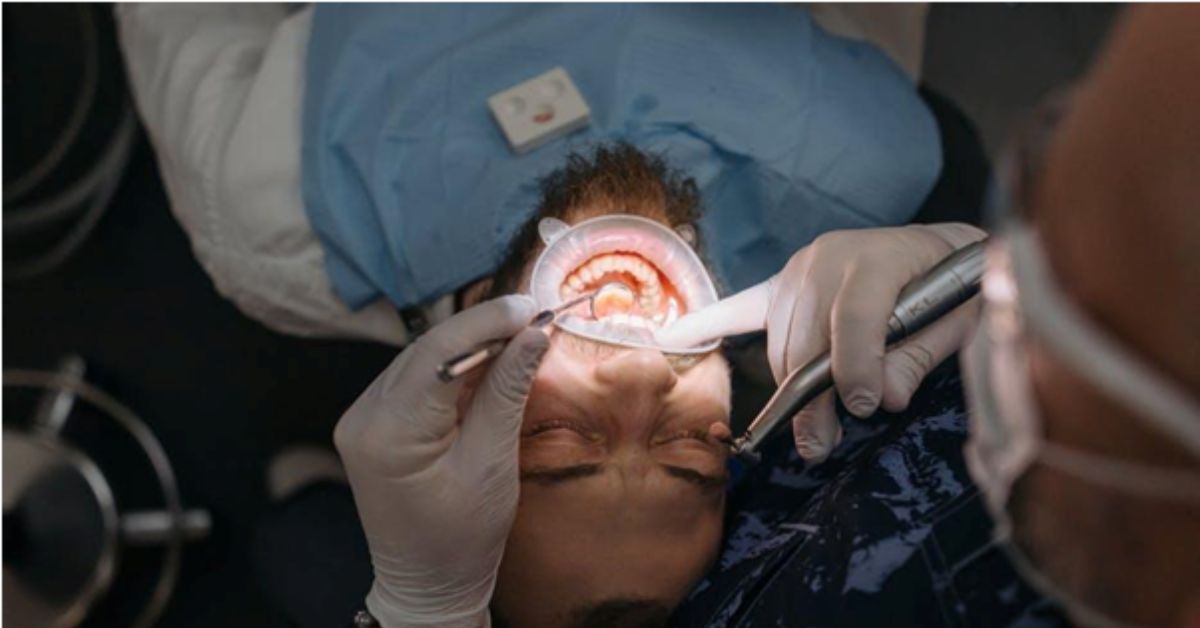 wisdom teeth removal