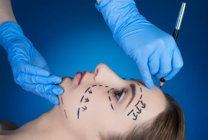 Facelift Surgery Guide