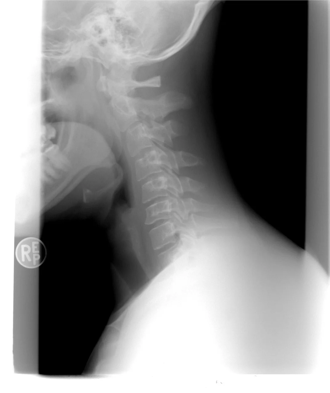 How Spine Health Affects Your Entire Body