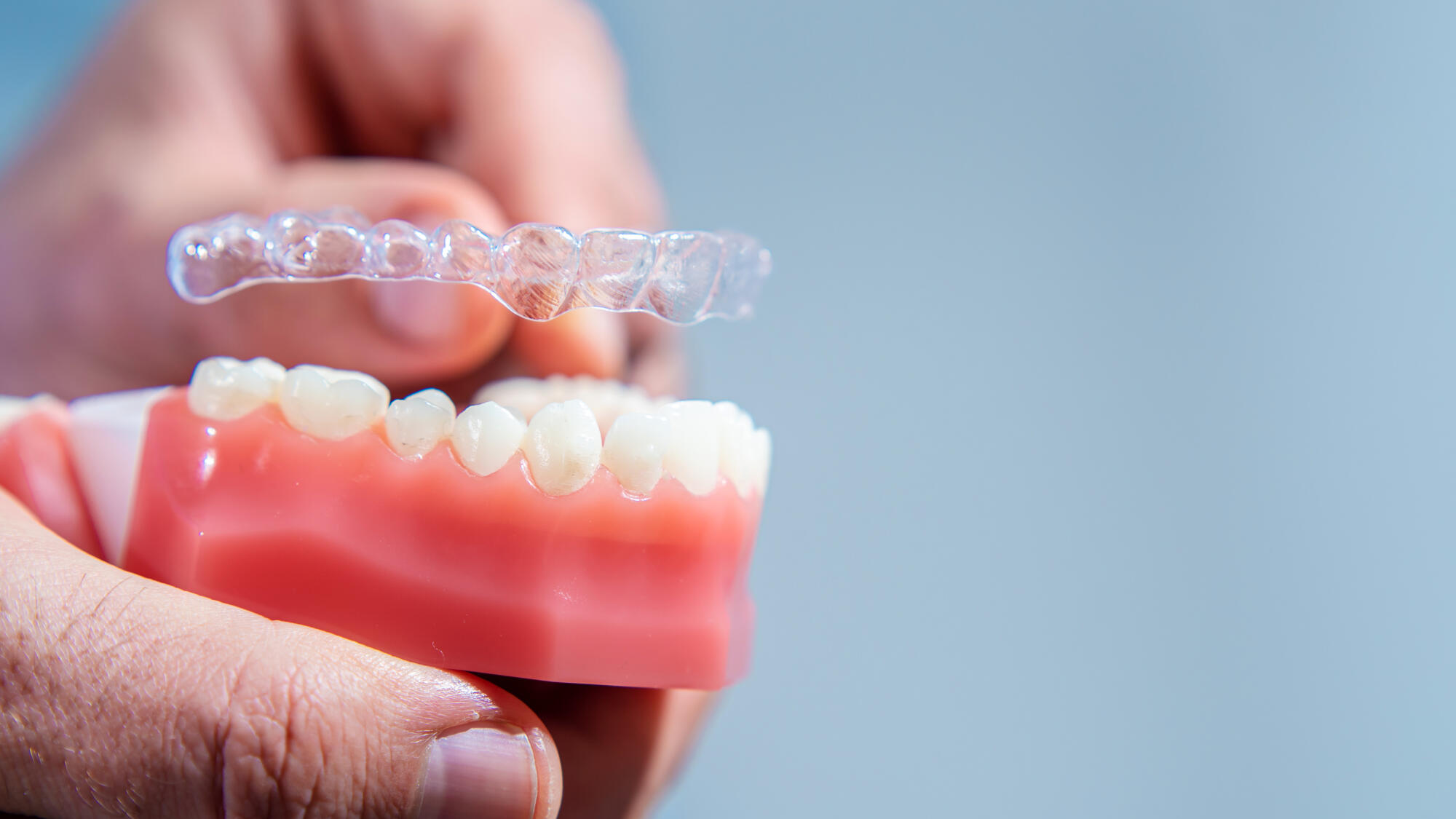 transparent braces