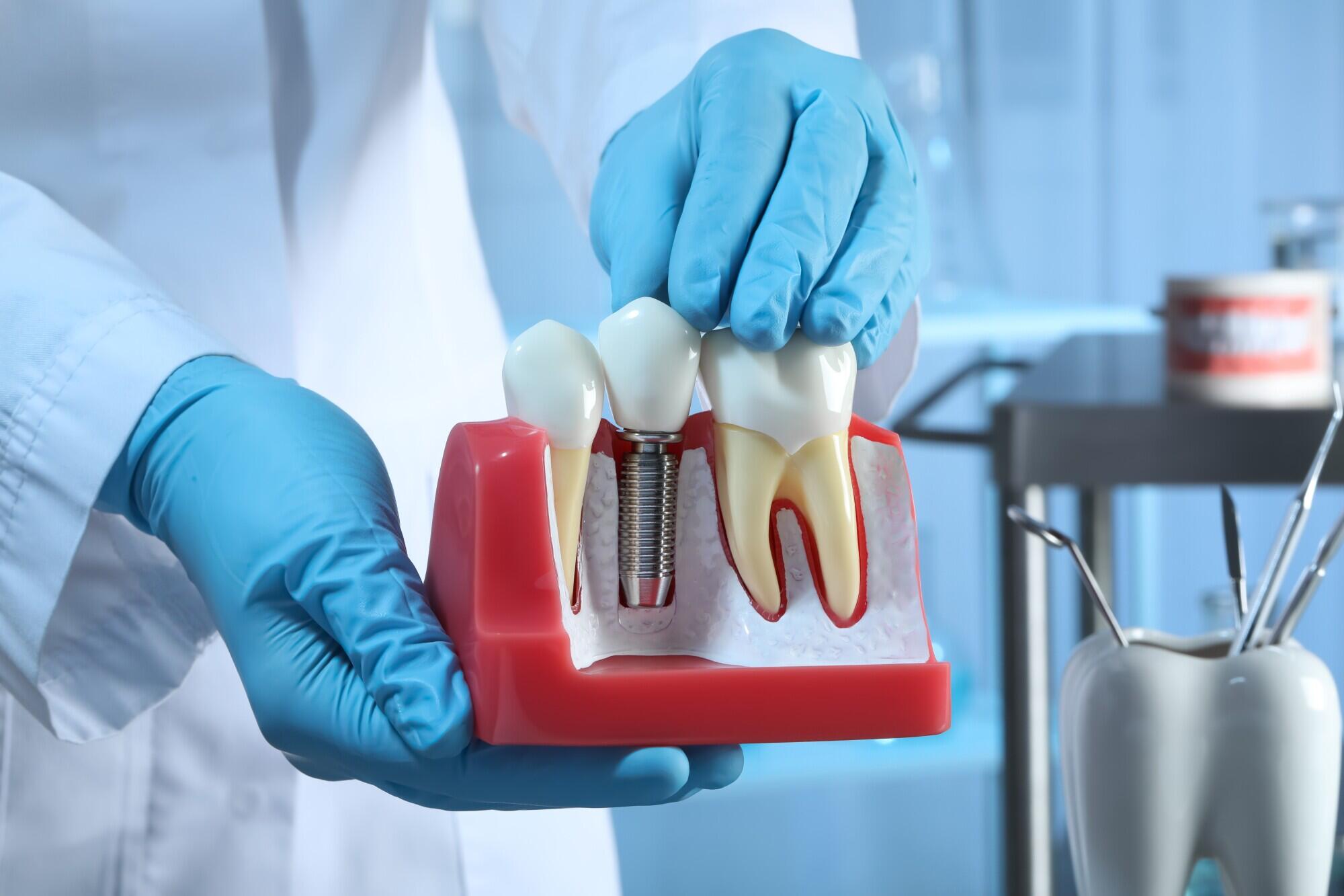 Tooth Replacement Options for Seniors