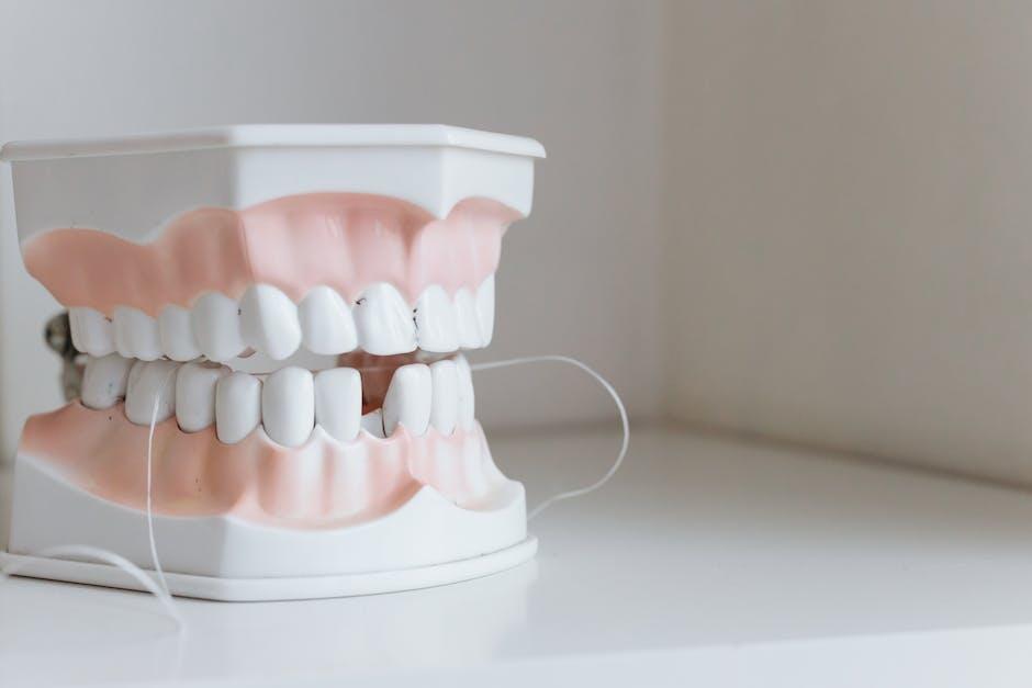 dental implants